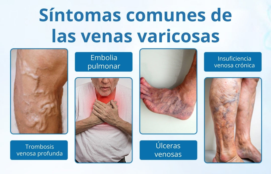 🎁Ourlyard® VeinGuard Spray de Hierbas-✅ Clínicamente probado para eliminar las venas varicosas en solo 7 días.