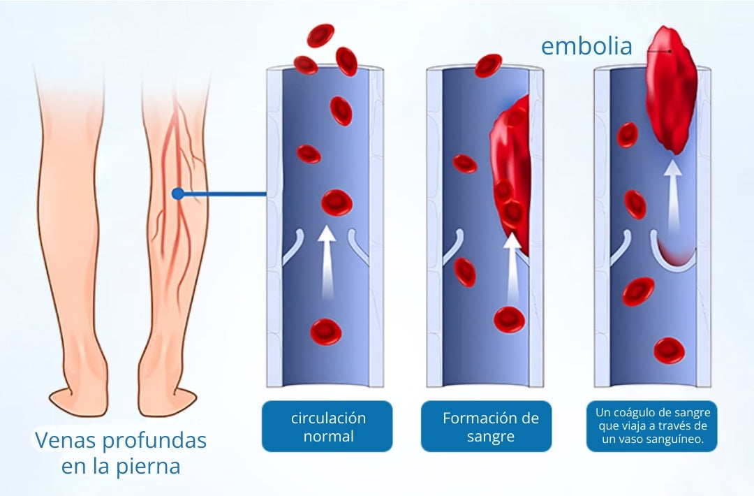 🎁Ourlyard® VeinGuard Spray de Hierbas-✅ Clínicamente probado para eliminar las venas varicosas en solo 7 días.